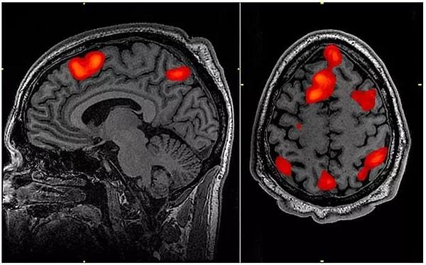 Öyle ki; yapılan bir incelemeye göre beyinde oluşan hareketleri gözlemleyen fMRI cihazının önüne yerleştirilen insanlara 1 saniyeden az bir süre için 'hayır' kelimesi gösterilmiş ve beyinlerinde oluşan haraketler gözlemlenmiş.