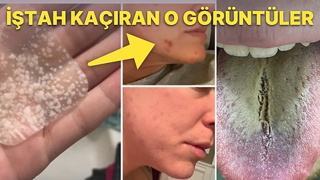 Yemek Yerken Bakmamanız Gereken Öncesi ve Sonrası Fotoğrafları