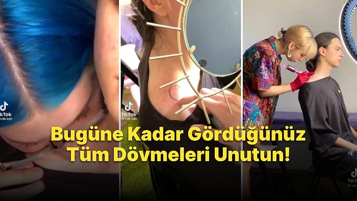 Kız Arkadaşının Omzuna Kondurduğu Isırık İzini Dövme Yaptıran Genç