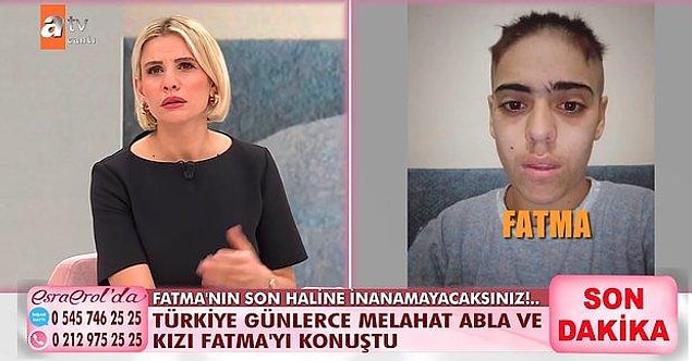Her ne kadar eve dönmeme konusunda ısrarcı olsa da Fatma, bir süre sonra ailesinin yanına gitmişti fakat daha sonra tekrar Ahmet'e kaçtığını, Ahmet'in ve kaynanasının saçlarını kazıdığını öğrenmiştik.