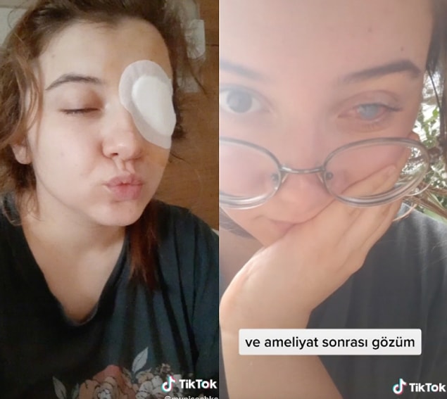 Gözünün hala tam olarak iyileşmediğini, girmesi gereken ameliyatlar olduğunu ve tedavi sürecinin devam etmekte olduğunu söylüyor ayrıca.
