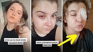 Lenslerini Çıkarmadan Uyuduğu İçin Korkunç Olaylar Yaşayan Genç Kadının TikTok Videosu Gündemde!