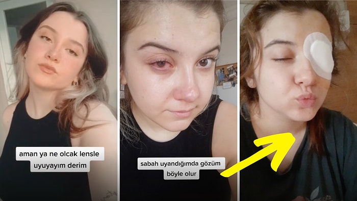 Lenslerini Çıkarmadan Uyuduğu İçin Korkunç Olaylar Yaşayan Genç Kadının TikTok Videosu Gündemde!