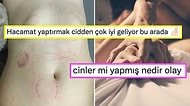 Hızını Alamayıp Cinsel İlişki Sonrası Vücudunun Isırık Dolu Fotoğrafını Paylaşan Kullanıcıya Gelen Yorumlar