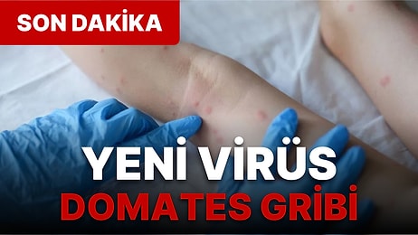 Yeni Salgın Alarmı Verildi! Domates Gribi Nedir, Nasıl Bulaşır? Domates Gribi Belirtileri Nelerdir?