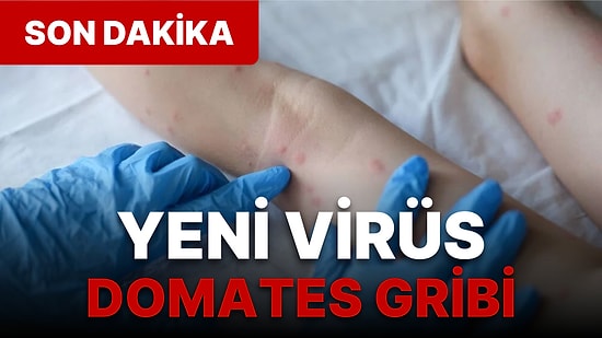 Yeni Salgın Alarmı Verildi! Domates Gribi Nedir, Nasıl Bulaşır? Domates Gribi Belirtileri Nelerdir?
