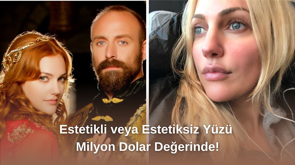 Reklam Yüzü Olduğu Markadan 182 Milyon Lira Kazanmış! Meryem Uzerli'nin Estetik Yolculuğunu İnceliyoruz