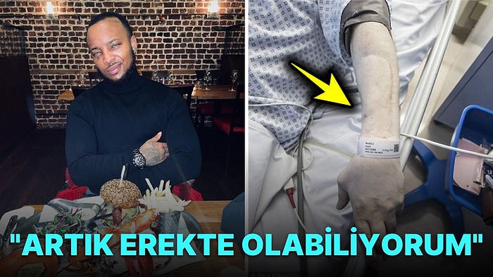 Cinsel Organı Olmadan Doğduğu İçin Kolundan Penis Yapılan Adamın Anlattıklarını Duyunca Dumur Olacaksınız!