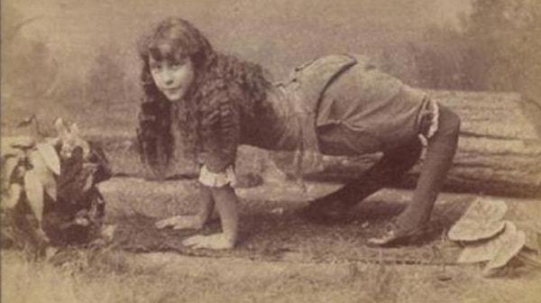 Sizleri 1850 yılında dizleri arkaya doğru bükülmüş bir şekilde dünyaya gelen Ella Harper ile tanıştıralım. Kendisi hayatı boyunca hep dört ayağının üzerinde yürümüş.