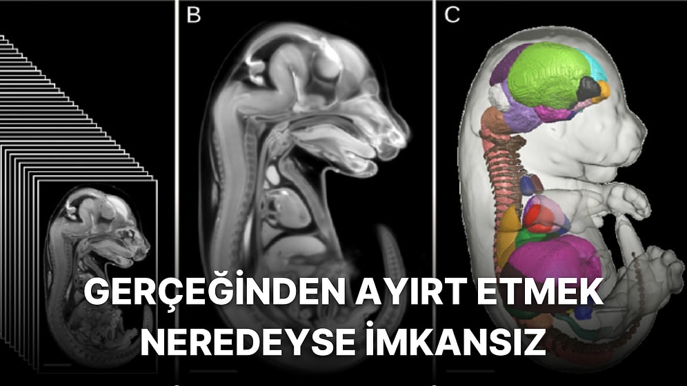 Yumurta veya Sperm Olmadan Kök Hücrelerle Üretilen Fare Embriyosunun Beyin ve Kalbi Oluştu