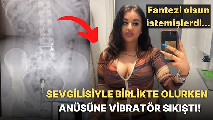 Sevgilisiyle Cinsel Birliktelik Yaşarken Eğlence Olsun Diye Anüsüne Vibratör Sokan Kadın Hastanelik Oldu!