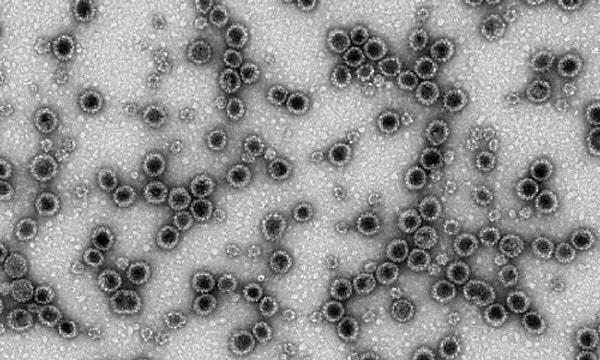 Ancak daha fazla analiz, yeni virüs polyomavirüsünün en yakın akrabasıyla yalnızca yüzde 60'lık bir eşleşme olduğunu gösterdi.