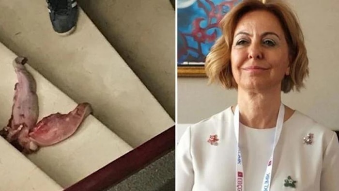 Prof. Dr. Esin Şenol’u 'Dana Dili' ile Tehdit Etmişti! Sahte Doktor Çıktı