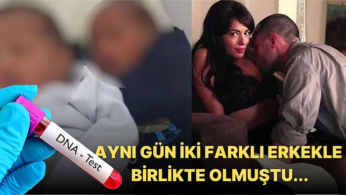 Aynı Günde İki Erkekle Cinsel Birliktelik Yaşadığı İçin İkizleri Farklı Babalardan Doğan Kadının Hikayesi