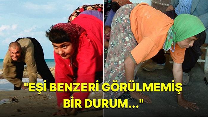 İki Ayak Yerine Dört Ayak Üzerinde Yürümeleri ile Tüm Dünyanın Kanını Donduran Türk Aile ile Tanışın!