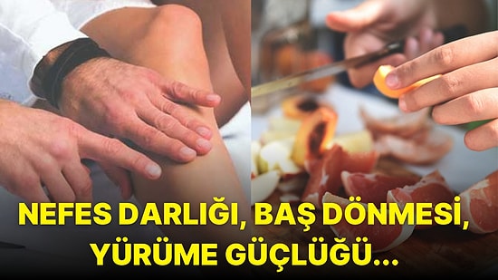 Neredeyse Bacağını Kaybediyordu! Her Gün Aynı Meyveyi Yediği İçin Tehlikeli Kan Pıhtılaşması Yaşayan Kadın