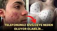 Vücudunuzun Farklı Bölgelerinde Çıkan Sivilceler Alışkanlıklarınız Hakkında Neler Söylüyor?