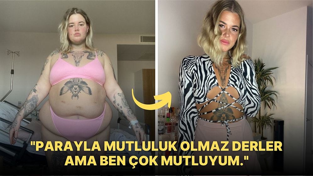 "Para Mutluluk Getirir mi?" Sorusuna "Evet" Diyerek Estetik Ameliyatlara Servet Harcayan Kadının Değişimi