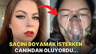 Saçını Boyadıktan Sonra Boyaya Alerjisi Olduğunu Öğrenen Bahtsız Kadının Yaşadıklarına İnanamayacaksınız!