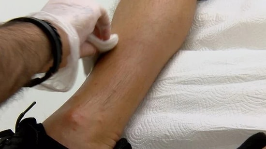 İstanbul’da Sivrisinek Alarmı: Ölüme Kadar Gidebiliyor