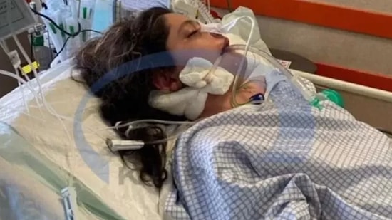 İran Karıştı: Ahlak Polisinin Komaya Soktuğu Kadın Hayatını Kaybetti
