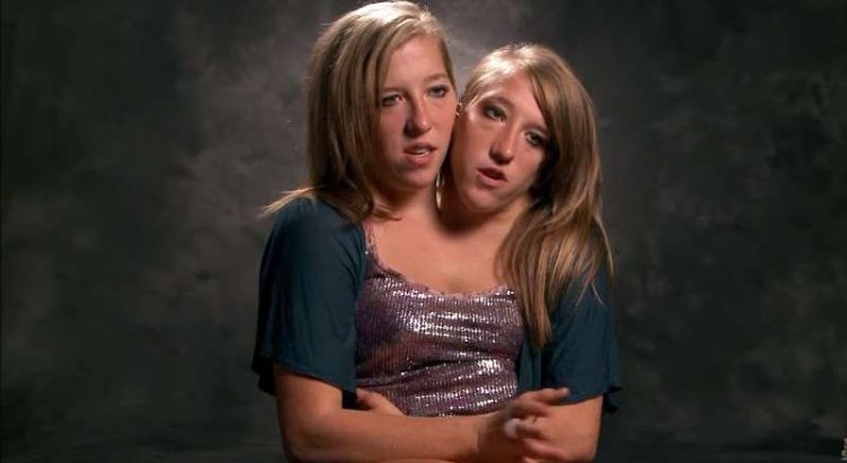 Conjoined Twins Abby And Brittany Hensel Now Their Careers Health And Dating History 