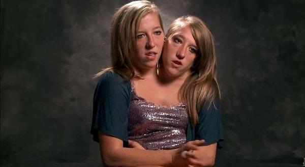 Mamamia - One body, two souls. The incredible lives of conjoined twins  Abby and Brittany Hensel.  hensel/