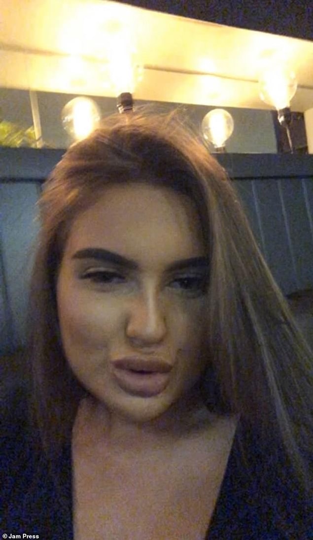 Hastanede Ruby'ye steroidler ve antihistaminikler verildi ve bununla kurtulduğu için çok şanslı olduğu söylendi.