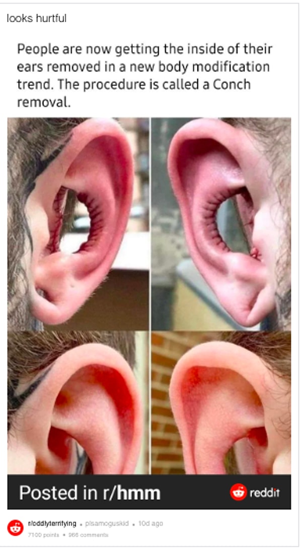 Удаление ушных раковин - новый тренд
