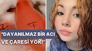 Suya Alerjisi Olduğu İçin Terlediğinde veya Duş Aldığında Cildi Benzin Dökülmüş Gibi Yanan Genç Kızın Dramı