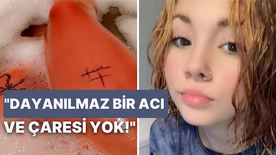 Suya Alerjisi Olduğu İçin Terlediğinde veya Duş Aldığında Cildi Benzin Dökülmüş Gibi Yanan Genç Kızın Dramı
