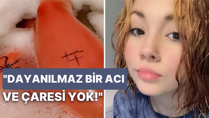 Suya Alerjisi Olduğu İçin Terlediğinde veya Duş Aldığında Cildi Benzin Dökülmüş Gibi Yanan Genç Kızın Dramı