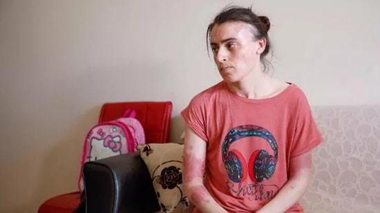 İstanbul’da Eski Elti Dehşeti: Şizofreni Hastası Olduğu Ortaya Çıktı