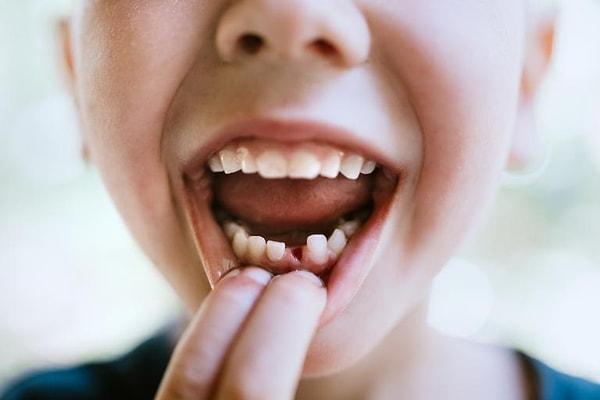 4. Dişlerin dökülmesi