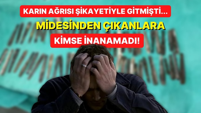 Şiddetli Karın Ağrısı Şikayetiyle Doktora Giden Adamın Midesinden Çıkan Şeylere İnanamayacaksınız!