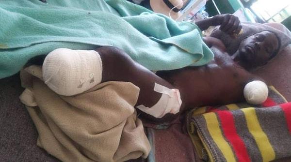 28 Eylül sabahı Batı Zimbabve'deki Mlibizi Nehri'nde kolunu koparan timsahla savaşan adam, yardım çığlıkları attı.