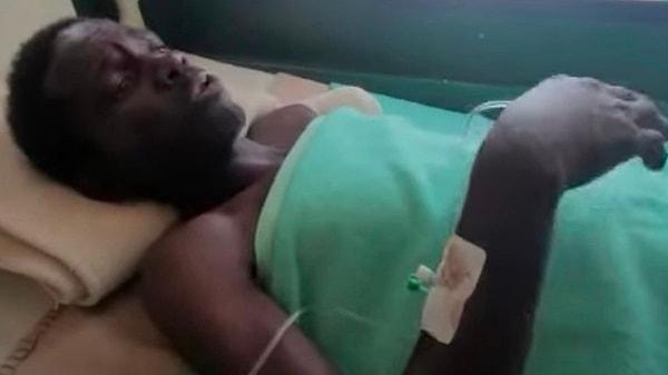 Zavallı adam, Zimbabwe'nin güneybatısındaki Bulawayo'da bulunan Mpilo Hastanesi'ne kaldırıldı.