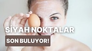 Siyah Noktalardan Arındırdığı Söylenen Beauty Yumurta Maskesi İncelemesi ve Yorumları