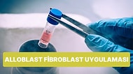 Alloblast Fibroblast Uygulaması ile Doğal Gençleşmek