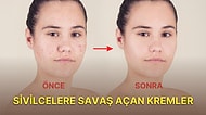 Kullananların Tavsiye Ettiği En İyi ve En Etkili Sivilce Kremi Önerileri