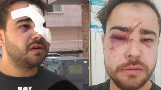 İkinci Onur Şener Vakası: İstek Parçayı Çalmadı Diye Yüzünde Şişe Kırdılar!
