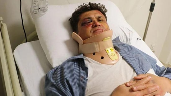 Sopalı Saldırıya Uğrayan Doktor: 'Biz Sağlık Çalışanları Sizlerden Biriyiz'