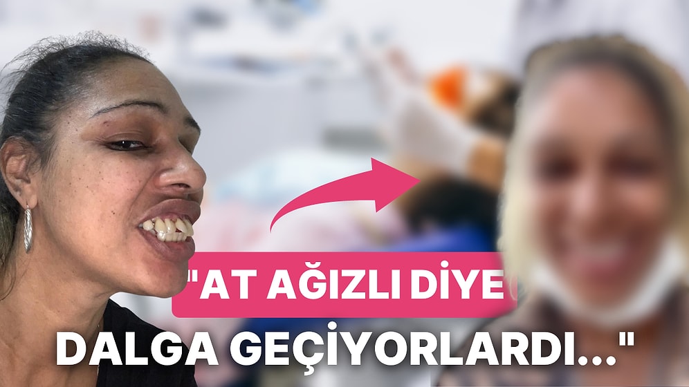 Ülkemize Gelip Dişlerini Yaptırdıktan Sonra Öz Güveninin Arşa Çıktığını Söyleyen Kadının Değişimi