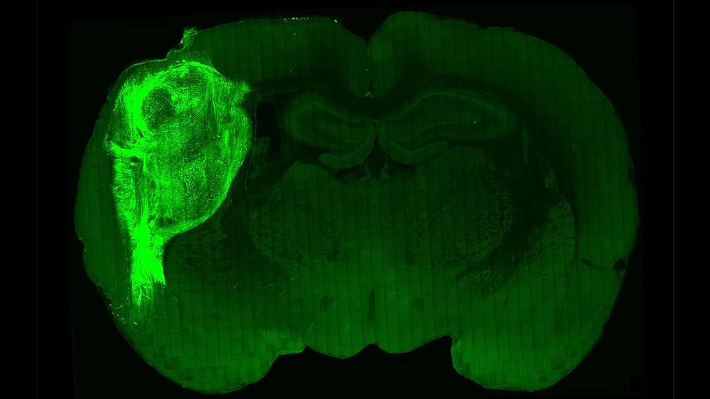 Human Neurons Successfully Transplanted Into Rat Brains, A Major Breakthrough in Science!