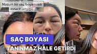 Saç Boyasına Alerjisi Olduğu İçin Gözünü Açamayacak Hale Gelen Kadının Başına Gelenleri Okumalısınız