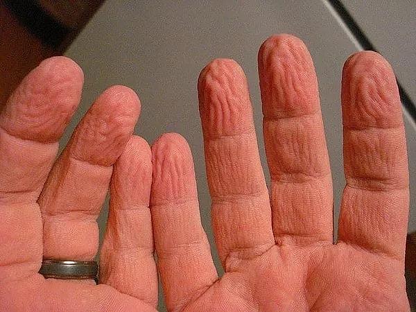 2. Parmaklarımızın suda uzun süre kaldığında buruşmasının nedeni derinin süngerimsi özelliğinden değil, ıslak nesneleri daha iyi kavrayabilmesi içindir.
