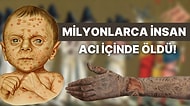 Modern Tıbbın Gelişimine Şükrettirip Orta Çağda Milyonlarca İnsanın Ölümüne Sebep Olan Bulaşıcı Hastalıklar