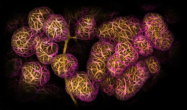 2nd Place - Breast tissue showing contractile myoepithelial cells wrapped around milk-producing alveoli