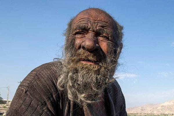 İran'ın Faraşbend şehrindeki bir köyde yaşan Amoo Hadji, tamı tamına 67 yıldır yıkanmayarak ve tıraş olmayarak dünya basınına konu olmuş ve 'dünyanın en kirli adamı' seçilmişti.