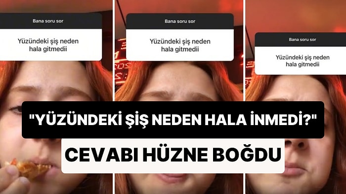 'Yüzündeki Şiş Neden Hala Gitmedi?' Sorusuna Verdiği Cevap ile Hüzne Boğan Kadın